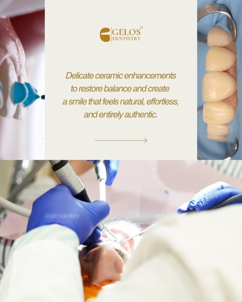 Smile transformation before and after result at Gelos Dentistry, Zirakpur