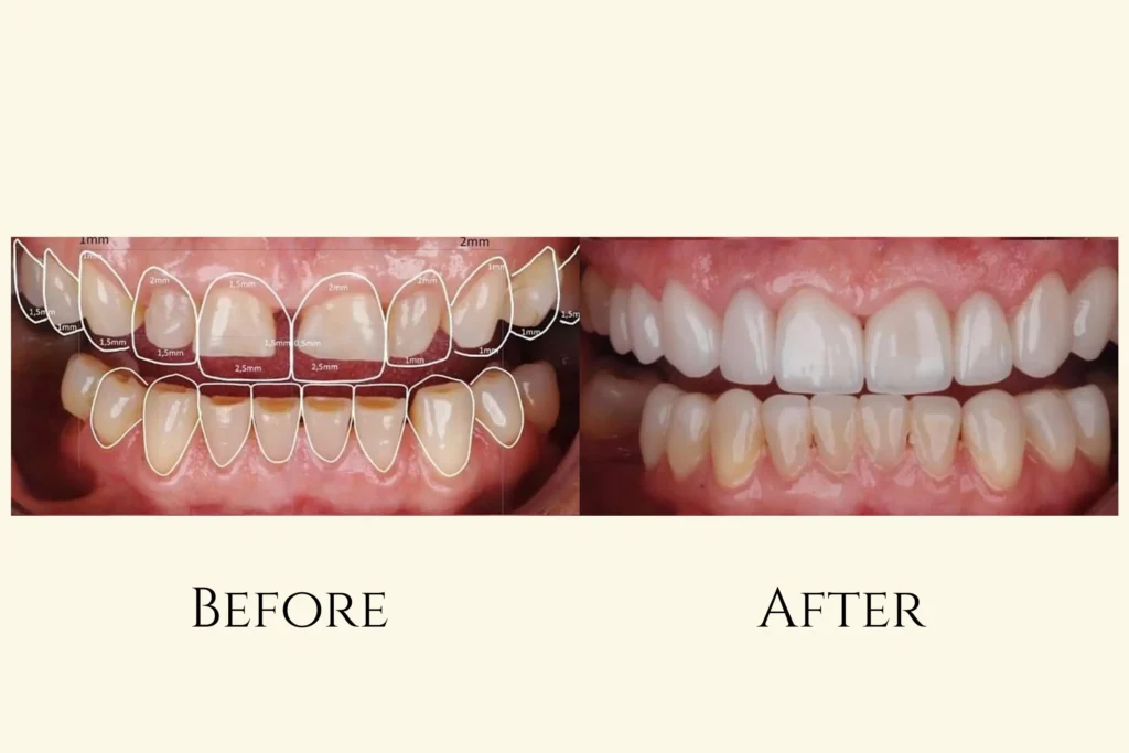 Cosmetic Dentistry at gelos Dentistry