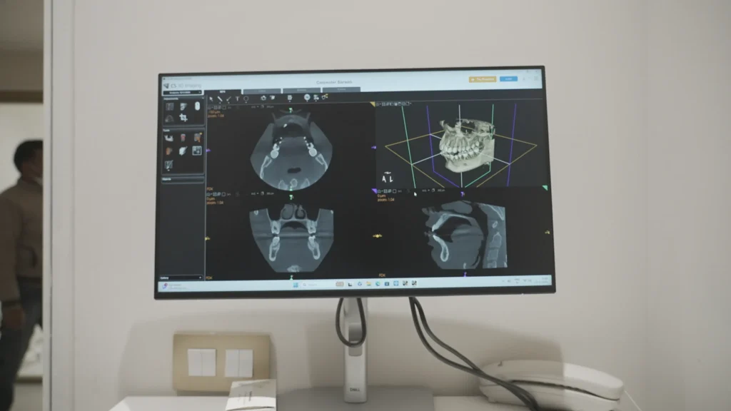 Gelos Dentistry - CBCT Scan