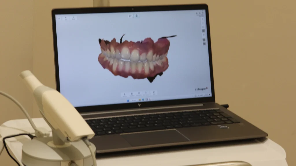5D intraoral scanner