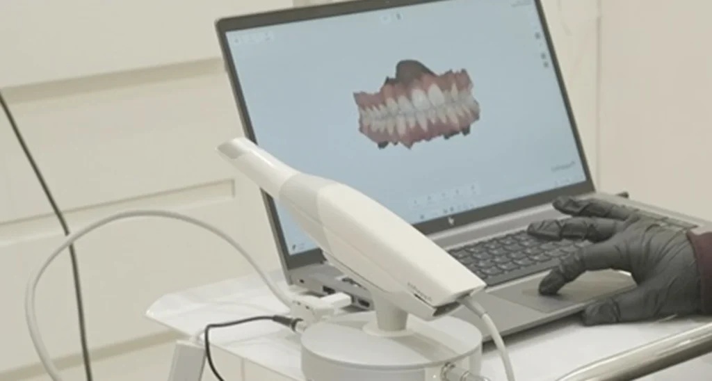 5D Intraoral Scanner at Gelos Dentistry