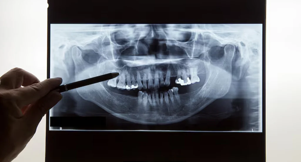 Digital Planning Session at Gelos Dentistry