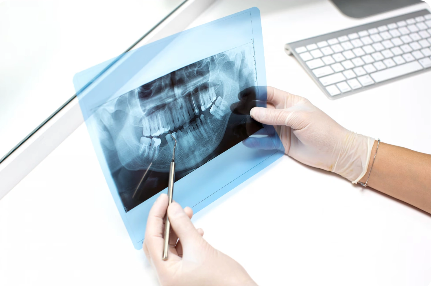 In‑House CBCT‑Guided Dental Implants in Tricity