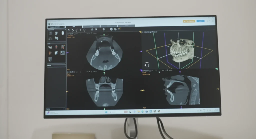 CBCT Scan at Gelos Dentistry