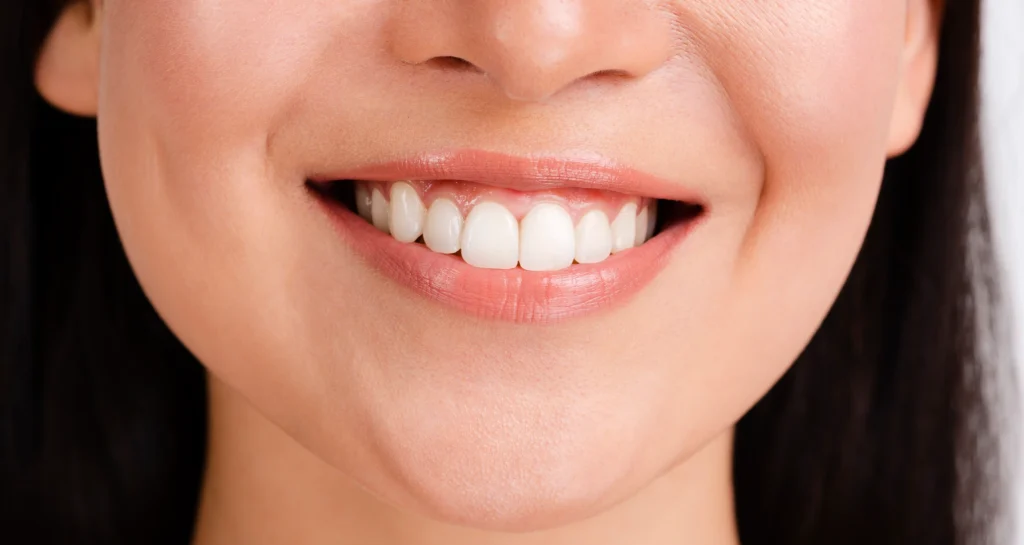 Digital Smile Design at Gelos Dentistry