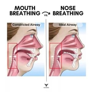What Is Airway Dentistry? Understanding the Connection Between Breathing, Sleep, and Oral Health