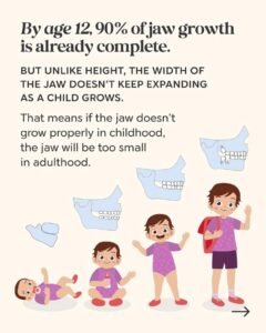 Illustration showing how facial growth and jaw development progress throughout childhood and adolescence.