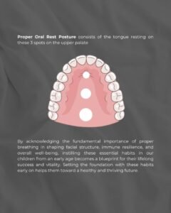 Illustration showing proper tongue posture at rest, with the tongue positioned against the upper palate at three contact points. Educational diagram explaining correct oral resting posture, nasal breathing, airway development, and healthy facial growth.