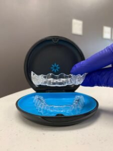 The Complete Guide to Clear Aligners: Everything Patients Need to Know