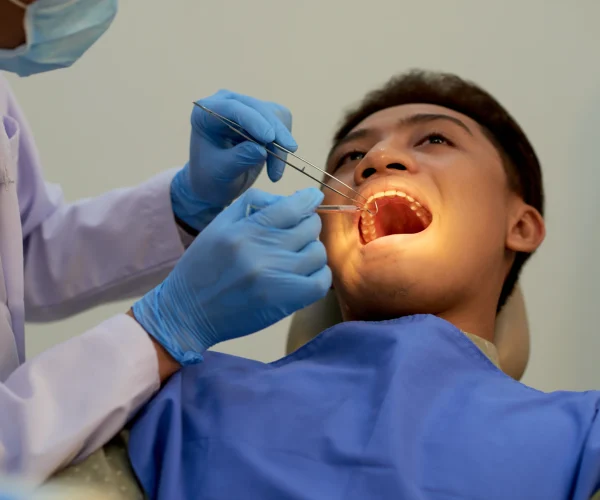 Oral Surgery at Gelos Dentistry