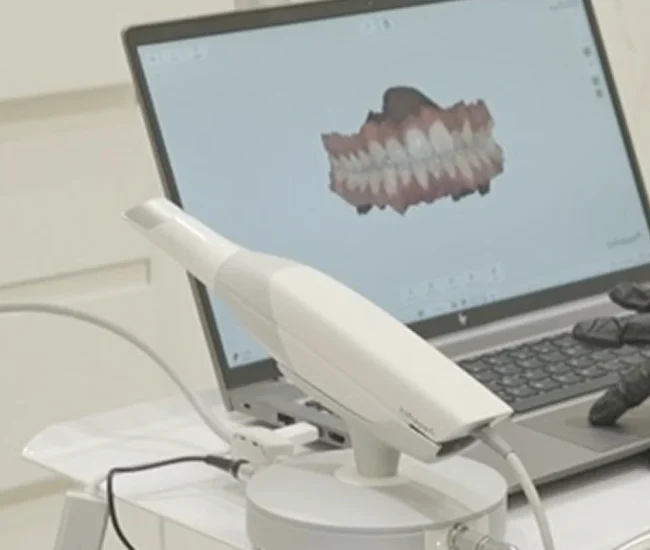 5D Intraoral Scanner at Gelos Dentistry