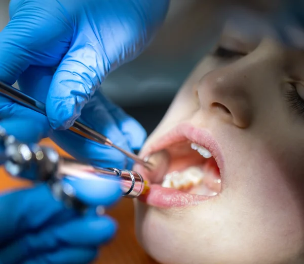 Cyst Removal and Minor Soft Tissue Surgery​ at Gelos Dentistry