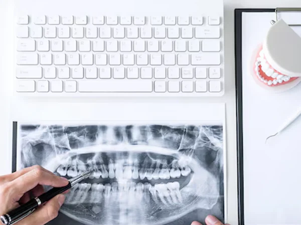 First Visit: Conversation and Check‑Up at Gelos Dentistry