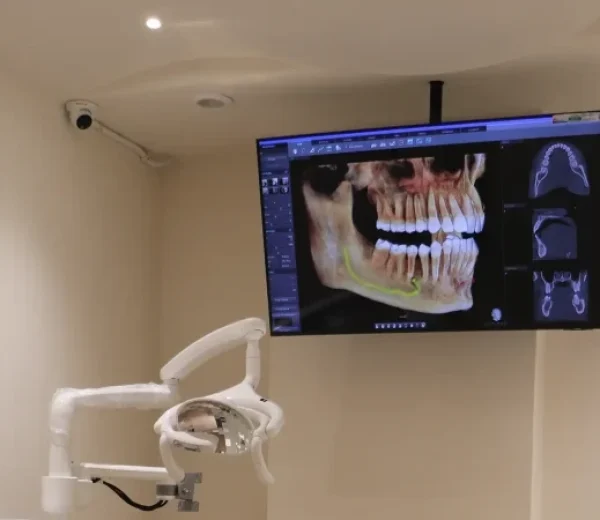Pre‑Implant and Pre‑Prosthetic Surgery​