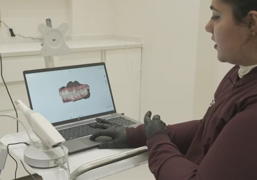 Showing You the Proposed Smile​