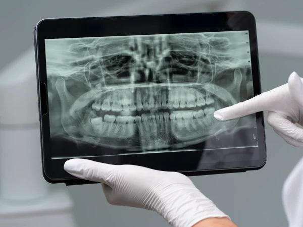 Detailed Consultation and Examination​ at Gelos Dentistry