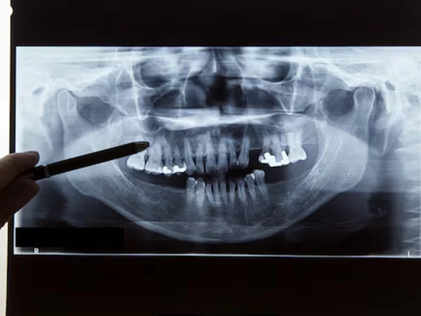 Digital Planning Session at Gelos Dentistry