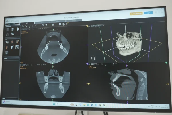 In House CBCT Scan at Gelos Dentistry