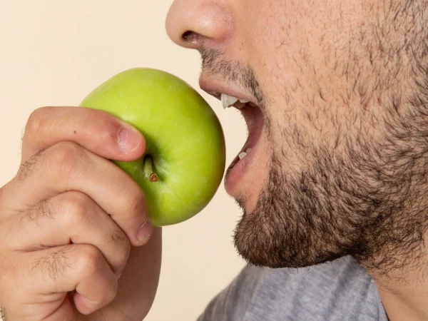 Post Treatment Results at Gelos Dentistry