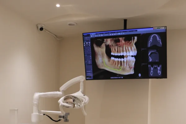 Digital Scans at Gelos Dentistry
