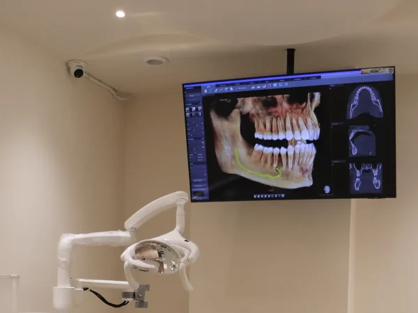 Digital Scans at Gelos Dentistry