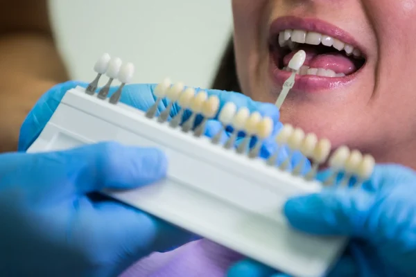 Examination and Planning at Gelos Dentistry