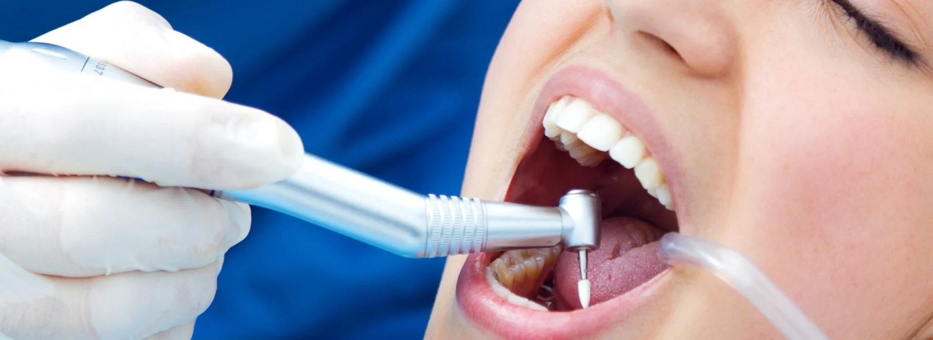 Full Mouth Rehabilitation at Gelos Dentistry