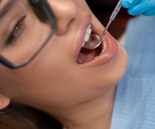 Full Mouth Rehabilitation at Gelos Dentistry​