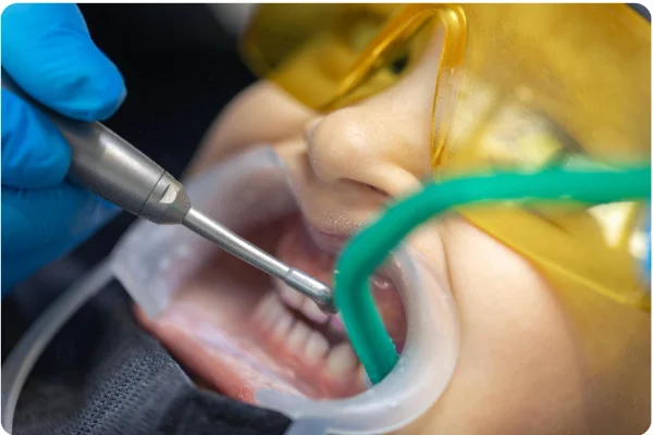 Gentle Pain Management​ at Gelos Dentistry