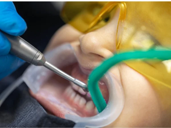 Gentle Pain Management​ at Gelos Dentistry