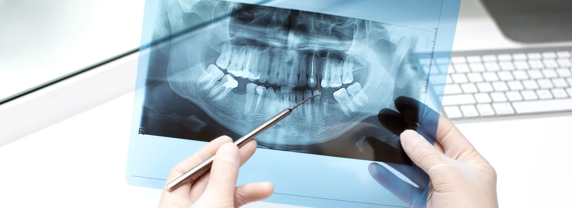 Digital Smile Design with 5D Intraoral Scanner at Gelos Dentistry