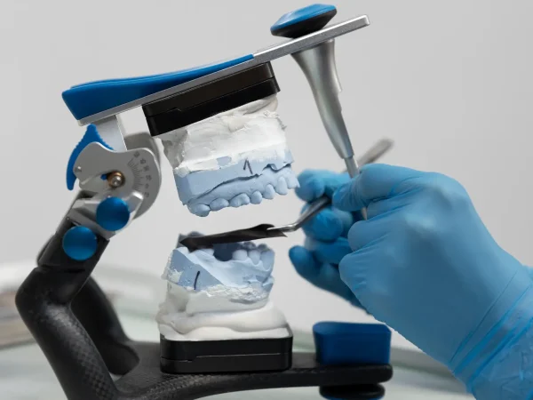 Lab Fabrication at Gelos Dentistry