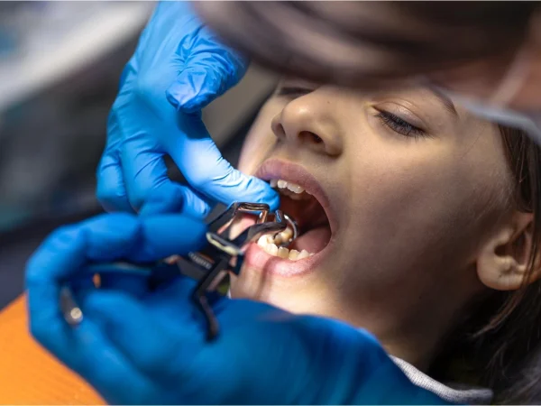 Emergency Dental Care for Kids​ at Gelos Dentistry