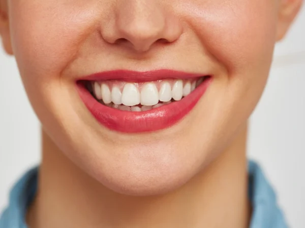 Post Treatment Results at Gelos Dentistry