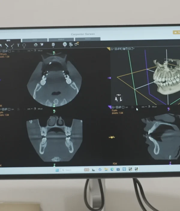 CBCT Scan at Gelos Dentistry