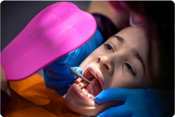 Stainless Steel and Tooth‑Coloured Crowns​ at Gelos Dentistry