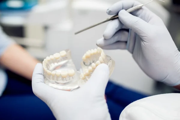 Tooth Preparation at Gelos Dentistry