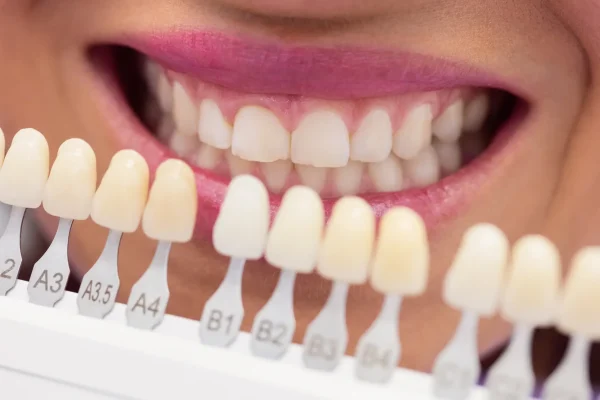 Zirconia Crowns at Gelos Dentistry