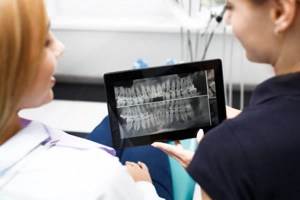 In House OPG at Gelos Dentistry