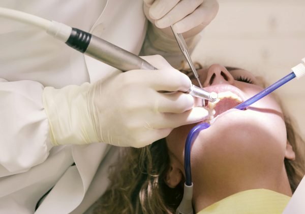 Gelos Dentistry Crown & Bridges Treatment