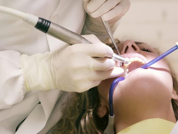 Gelos Dentistry Crown & Bridges Treatment