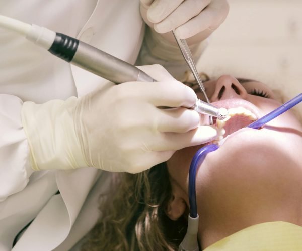 Gelos Dentistry Crown & Bridges Treatment