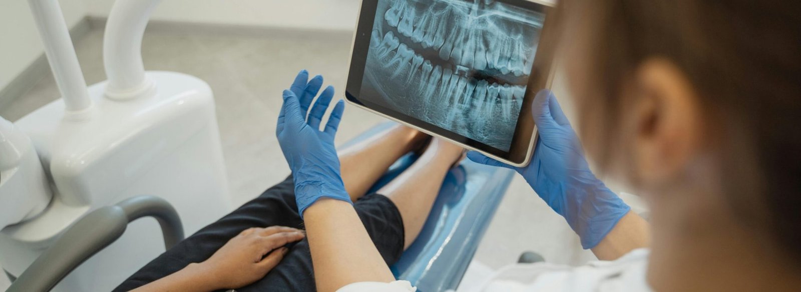 Dental Crowns & Bridges at Gelos Dentistry