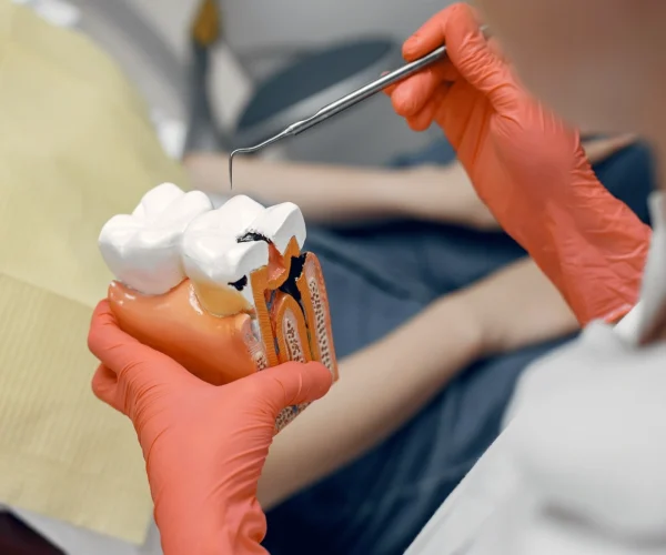 Microscopic Root Canal Treatment at Gelos Dentistry