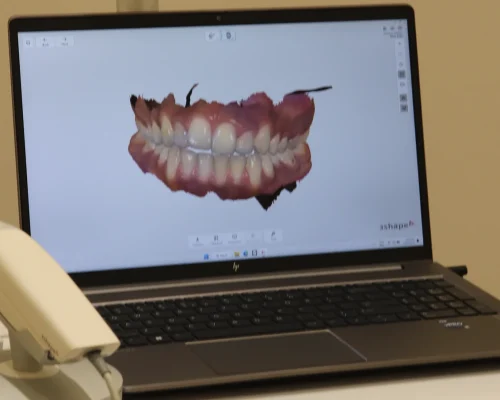 5D Intraoral Scanner at Gelos Dentistry